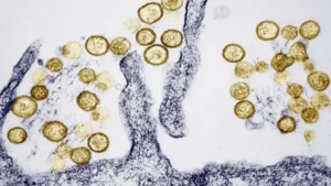 From Rodents to Cruise Cabins How Hanta Virus Is Spreading Concern